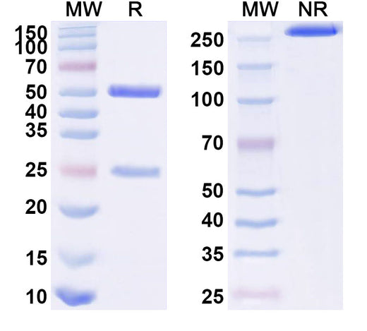 SDS-PAGE for Anti-HPV18 E7/Protein E7 Antibody (SAA2229)