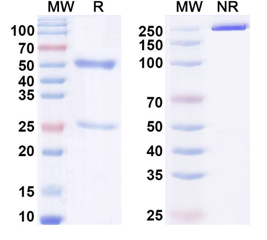 SDS-PAGE for Anti-HSV-2/HHV-2 gB/Envelope glycoprotein B Antibody (SAA2248)