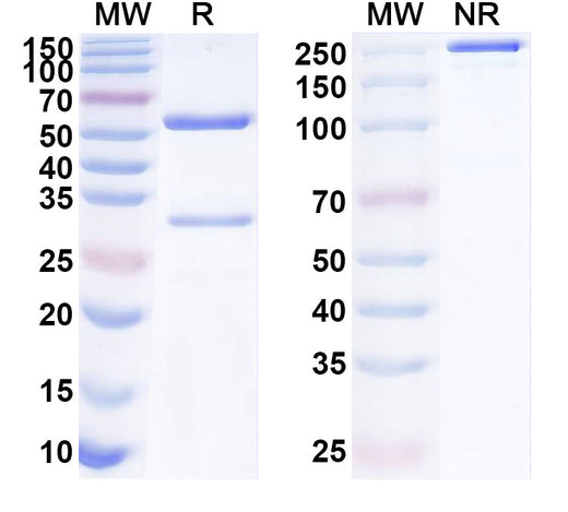 SDS-PAGE for Anti-Human ATF7 Antibody (ABS1603)
