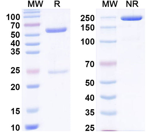 SDS-PAGE for Anti-Human C5/Complement C5 Monoclonal Antibody, SAA0831