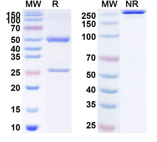 SDS-PAGE for Anti-Human CALD1 Monoclonal Antibody (1A551)