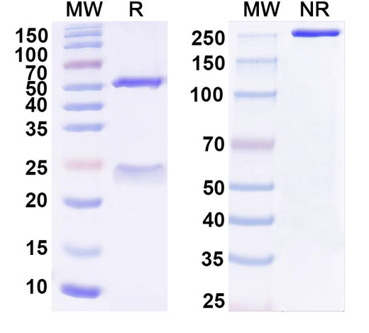 SDS-PAGE for Anti-Human CD2AP Monoclonal Antibody (1A674)