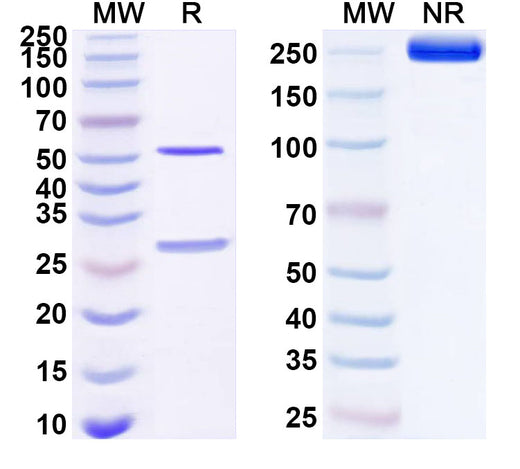 SDS-PAGE for Anti-Human CDCA8/Borealin Antibody (SAA2354)