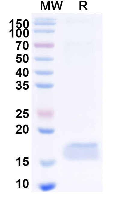 SDS-PAGE for Anti-Human CEP164 VHH (10Z)
