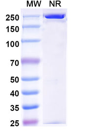 SDS-PAGE for Anti-Human Complement C5b-9 Complex Antibody (aE11#)