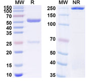 SDS-PAGE for Human DNMT1 IP Monoclonal Antibody SAA0251