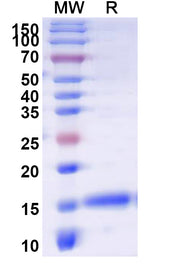 SDS-PAGE for Anti-Human DPP6 VHH (SAA1245)