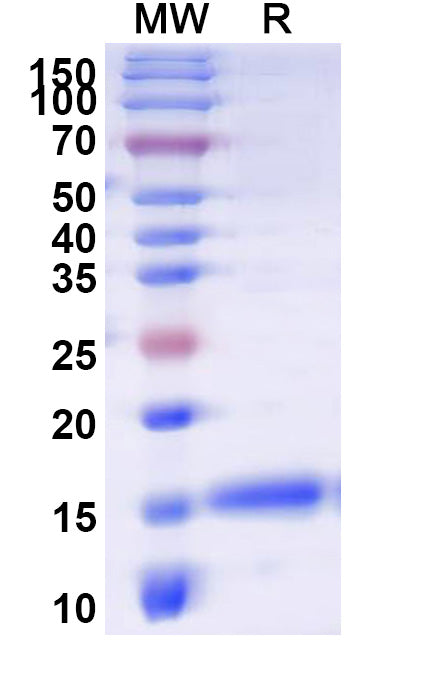 SDS-PAGE for Anti-Human DPP6 VHH (SAA1245)