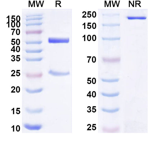 SDS-PAGE for Anti-Human GP2 Monoclonal Antibody (1A656)