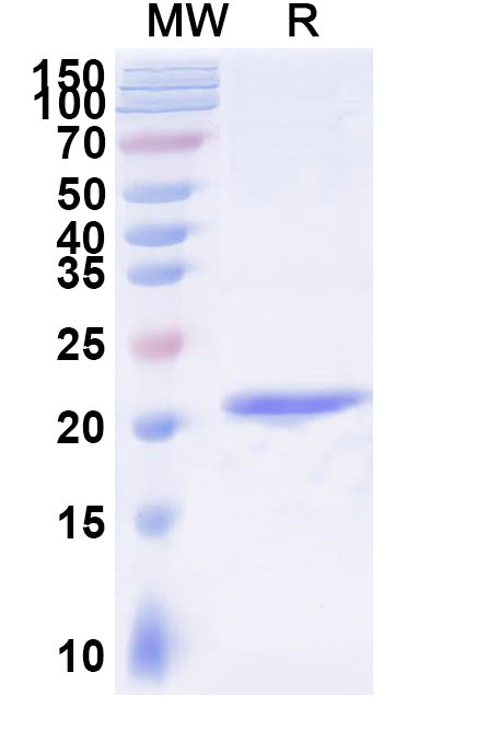 SDS-PAGE for Anti-Human GSN VHH (SAA1011)
