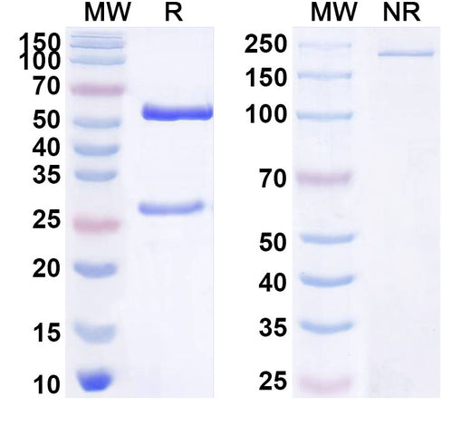 SDS-PAGE for Anti-Human HDGF Antibody (ABS0027)