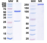 SDS-PAGE for Anti-Human HSPA9/Mortalin/GRP75 Antibody (SAA0812)