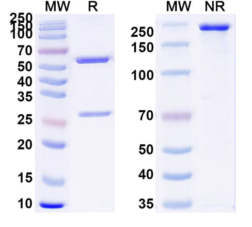 SDS-PAGE for Anti-Human INPP5D Monoclonal Antibody (1A540)
