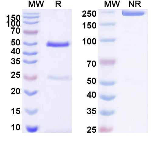SDS-PAGE for Anti-Human MYL9 Antibody (ABS0246)