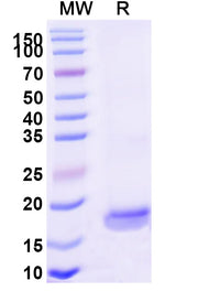 SDS-PAGE for Anti-Human OPRK1 VHH (SAA1169)