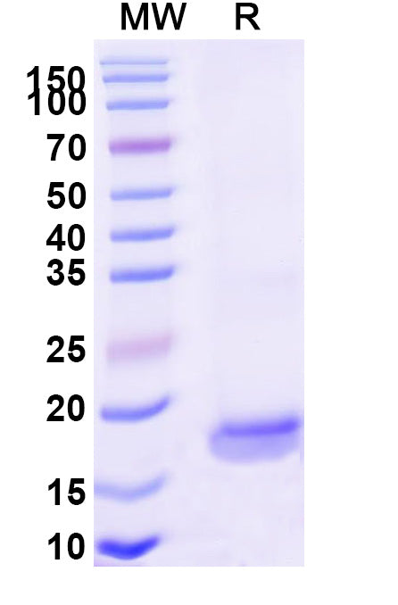 SDS-PAGE for Anti-Human OPRK1 VHH (SAA1169)
