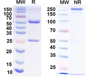 SDS-PAGE for Anti-Human PHF8 IP Antibody (SAA0216)
