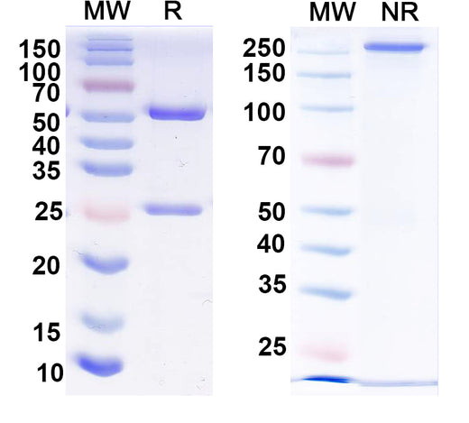 SDS-PAGE for Anti-Human PHF8 IP Antibody (SAA0216)
