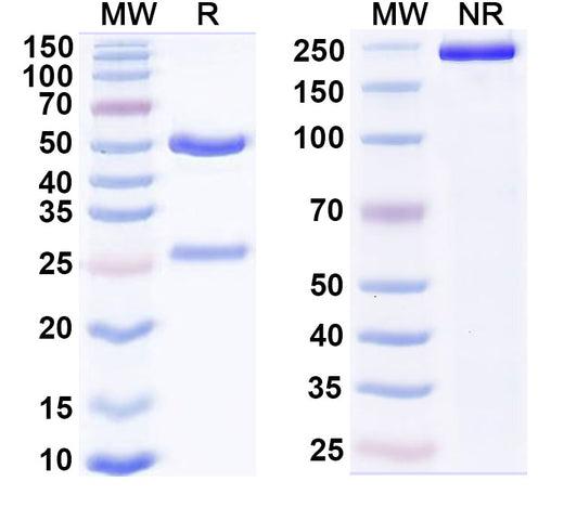 SDS-PAGE for Anti-Human SH2D1A Monoclonal Antibody (1A650)