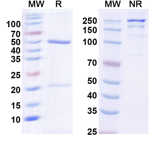 SDS-PAGE for Anti-Human SLC15A4 Antibody (SAA2355)