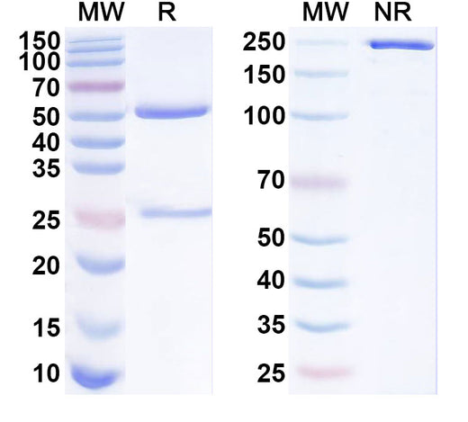 SDS-PAGE for Anti-Human ST14 Antibody (A11)