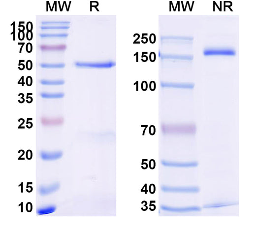 SDS-PAGE for Anti-Human TNFa/TNF-alpha Antibody (SAA2233)
