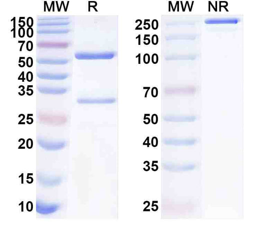 Anti-Human TRBV17 Antibody (ABS1092)
