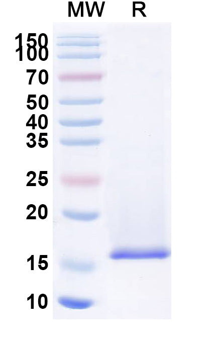 SDS-PAGE for Anti-JUNV Nucleoprotein VHH (SAA2268)