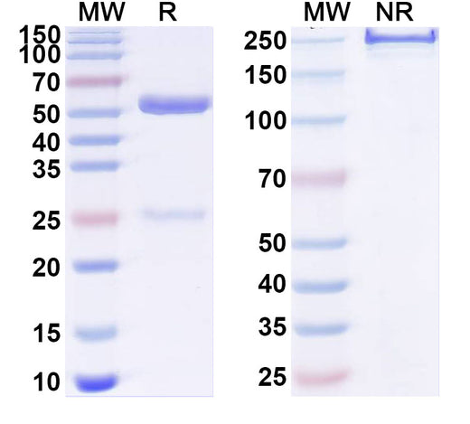 SDS-PAGE for Anti-Mouse CD11c/ITGAX Antibody (N418)