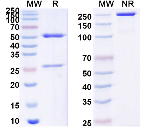 SDS-PAGE for Anti-PHLPXI Antibody (SAA0735)