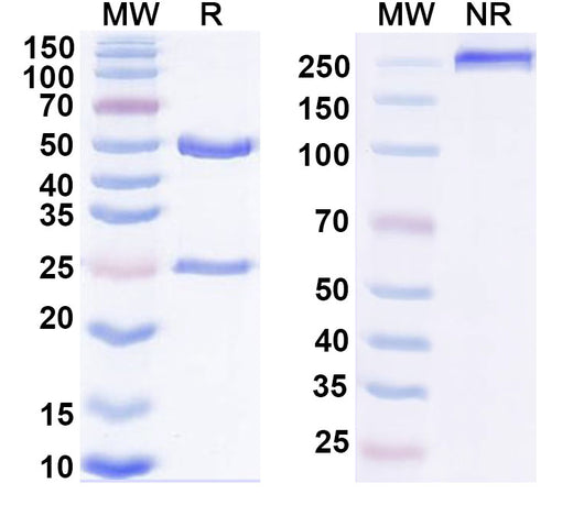 SDS-PAGE for Anti-Phospholipid Antibody (SAA2402)