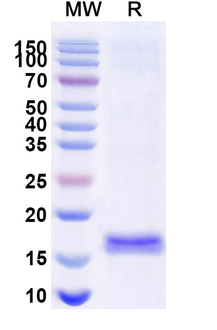 SDS-PAGE for Anti-Porphyromonas gingivalis VHH (SAA1181)