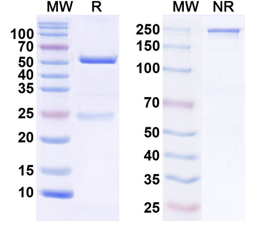 SDS-PAGE for Anti-POTRA domain-containing protein/OMP Antibody (SAA2421)
