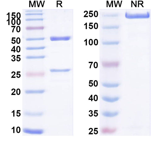 SDS-PAGE for Anti-Profilin Antibody (SAA2304)