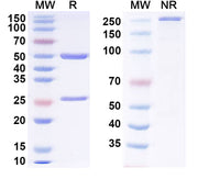 SDS-PAGE for Anti-Progesterone Antibody (DB3)
