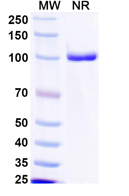 SDS-PAGE for Anti-PRRSV NP/Nucleoprotein Antibody (SAA2530)