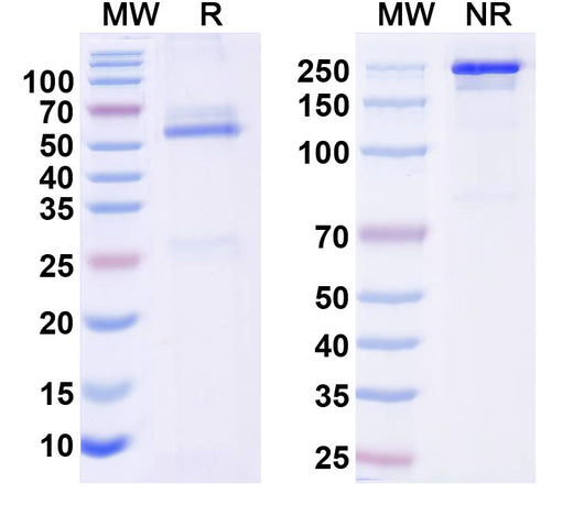 SDS-PAGE for Anti-REEP2 Antibody (N326B/47)