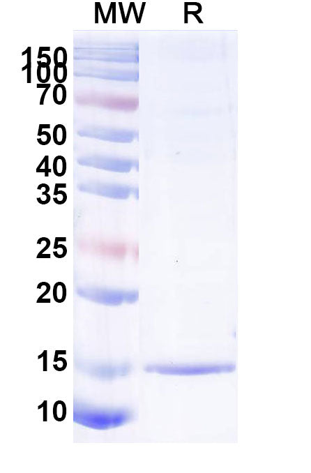 SDS-PAGE for Anti-SARS-CoV-2 S Protein VHH (SAA1060)