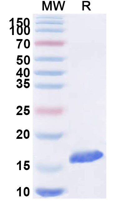 SDS-PAGE for Anti-SARS-CoV-2 S Protein VHH (SAA1074)