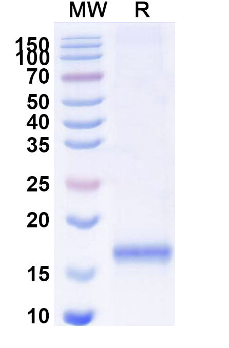 SDS-PAGE for Anti-SARS-CoV-2 S Protein VHH (SAA1091)