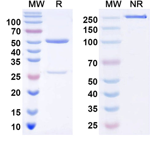 SDS-PAGE for Anti-Slo2.1/Slick K+ channel Antibody (N11/24)