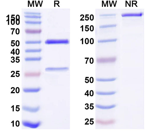SDS-PAGE for Anti-Snake Venom Antibody (D09)