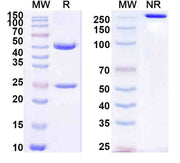 Anti-Staphylococcus aureus Protein A/SPA Antibody (SAA1453)