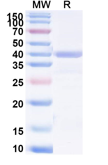 SDS-PAGE for ATP7B, N-His, recombinant protein
