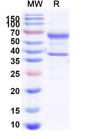 SDS-PAGE for beta-nerve growth factor(NGF)
