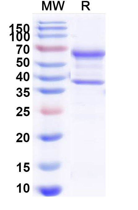 SDS-PAGE for beta-nerve growth factor(NGF)
