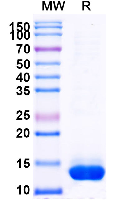 SDS-PAGE for BID Protein - BH3-interacting domain death agonist(BID)