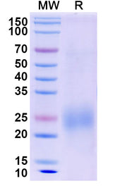 SDS-PAGE for Canine IL31 recombinant protein