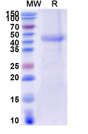 SDS-PAGE for CD116 / CSF2RA, C-His, recombinant protein