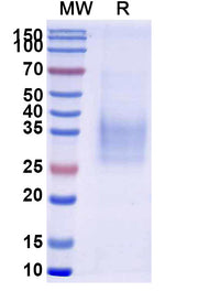 SDS-PAGE for CD47 Recombinant Protein (Human)